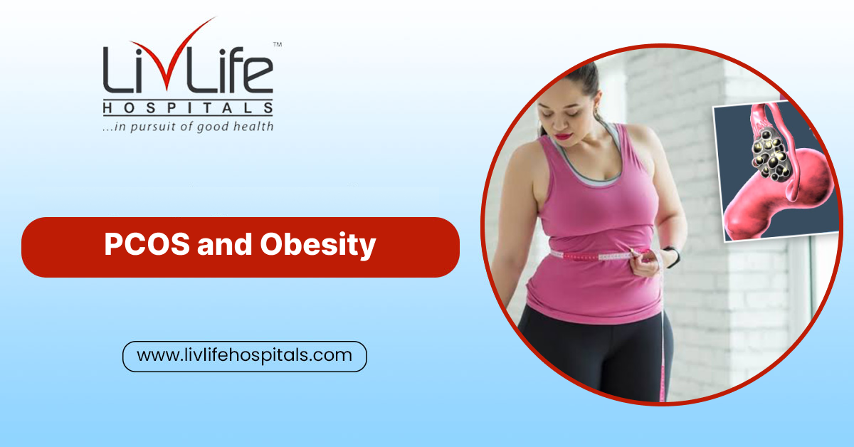 PCOS and Obesity