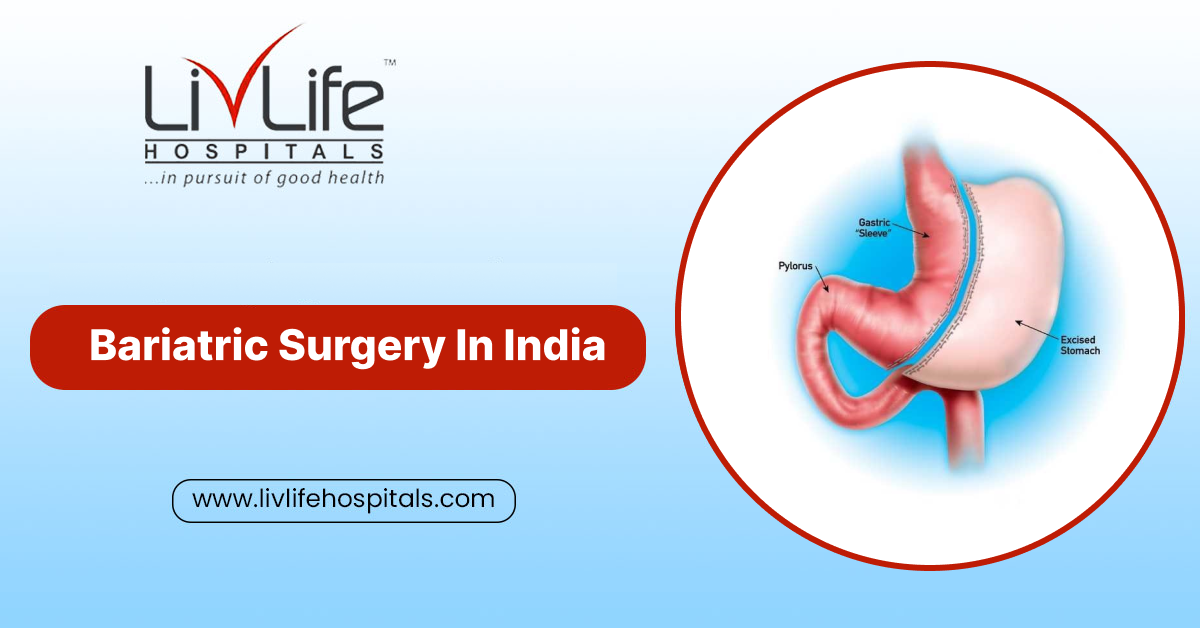 Bariatric Surgery In India