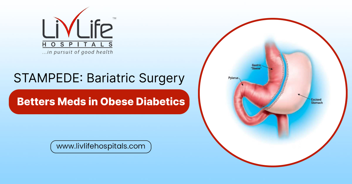 STAMPEDE: Bariatric Surgery Betters Meds in Obese Diabetics