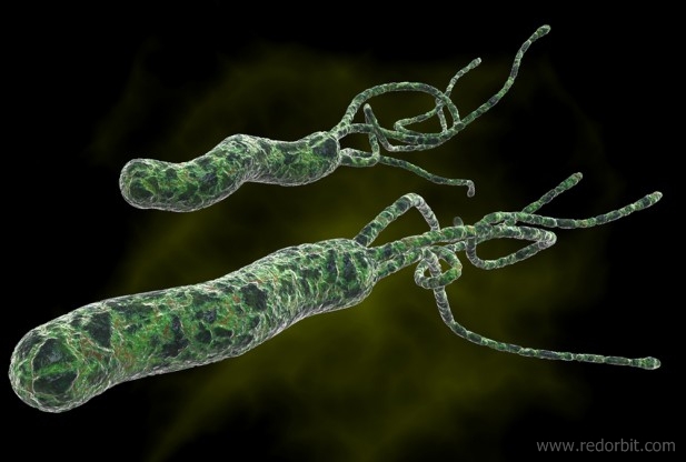 H.pylori Treatment and Weight Gain
