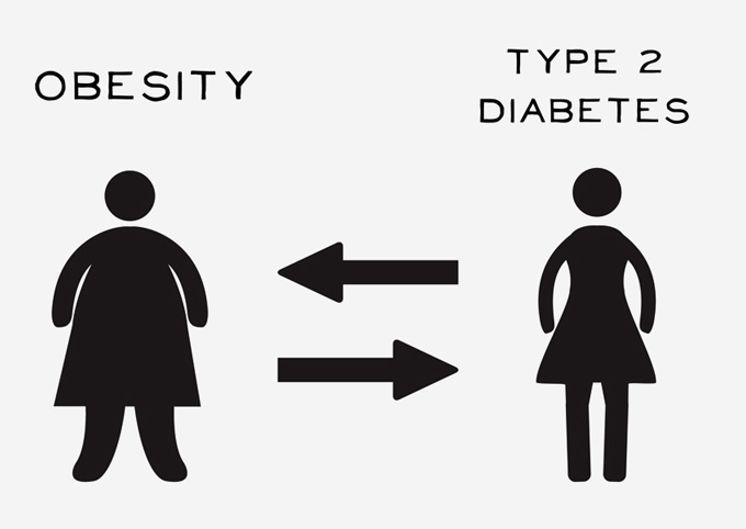 Type 2 Diabetes should be prioritized for Surgery