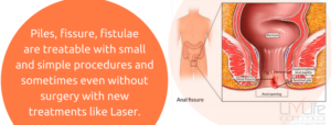 Piles, fissure, fistulae are treatable with small and simple procedures