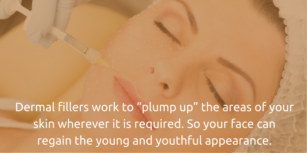 Dermal fillers work to “plump up” the areas of your skin.