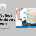 What You Need Before Weight Loss Surgery