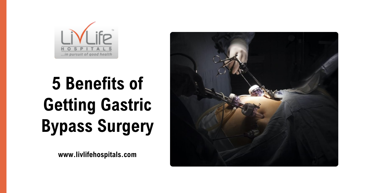 Beyond Weight Loss – 5 Benefits of Getting Gastric Bypass Surgery
