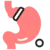 Adjustable Gastric Banding