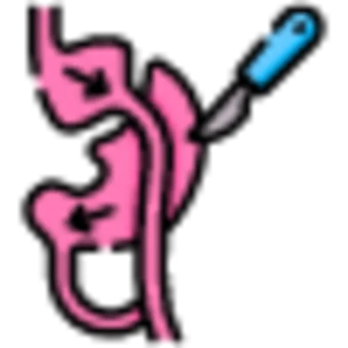 Gastric Bypass