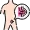 Gastric Sleeve