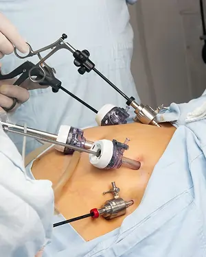 bariatric-surgery