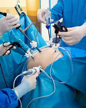 laparoscopic-surgery
