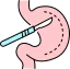 bariatric-surgery
