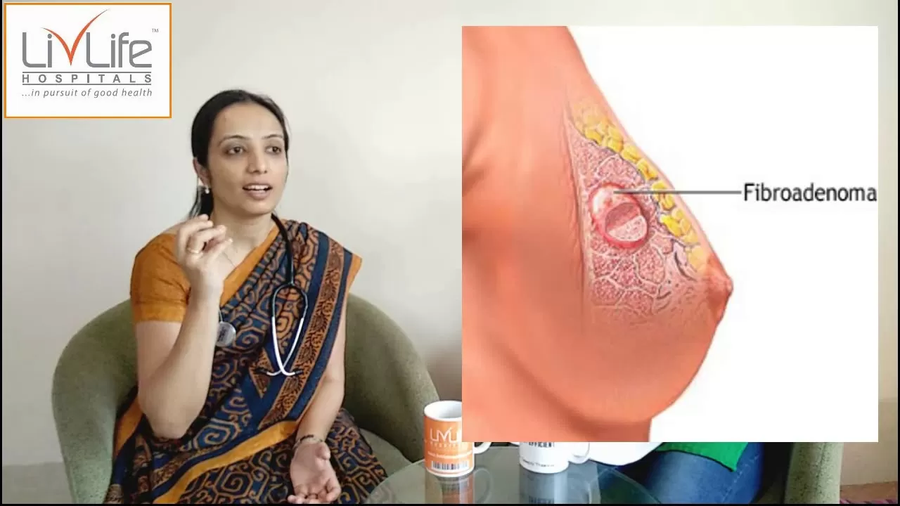 Breast Lump explained by Livlife hospitals Surgeon